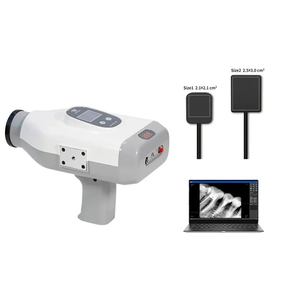 Рентгенов апарат за Високочестотни цифров стоматологичен рентгенов апарат, Преносим подробен рентгенов апарат с USB-сензор за визуален контрол RVG Изображение 0